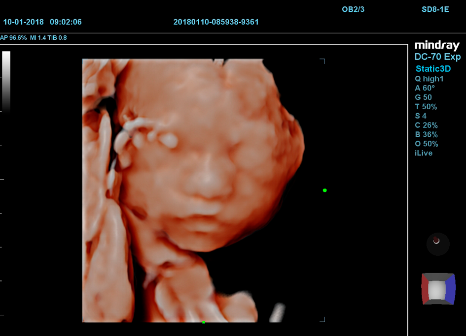 Imagen Clinica DC70 iLive