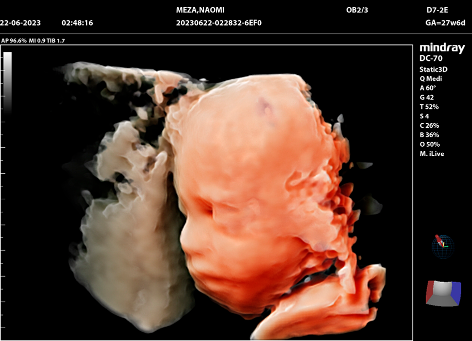 Imagen Clinica DC70 iLive con Hyline